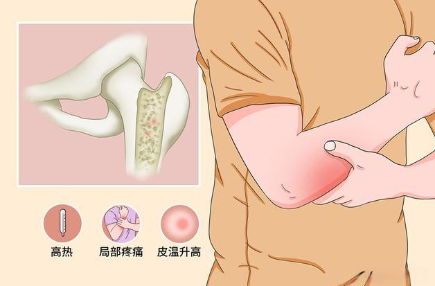 邵陽創(chuàng)傷骨科,邵陽風濕病區(qū),邵陽骨質(zhì)增生,邵陽關節(jié)病區(qū),邵陽頸椎病區(qū)