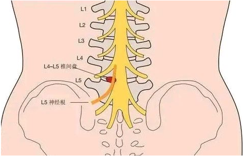 邵陽創(chuàng)傷骨科,邵陽風濕病區(qū),邵陽骨質(zhì)增生,邵陽關(guān)節(jié)病區(qū),邵陽頸椎病區(qū)